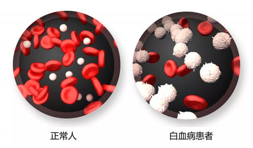 奥法木单抗联合用药已被批准