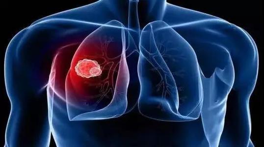 药品新进展 | 肺癌靶向药汇总最新资讯更新